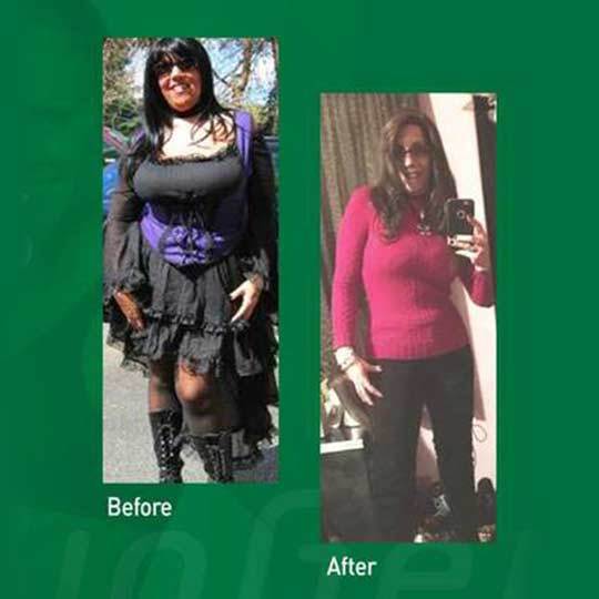 HCG ALTERNATIVE™ Weight Loss Pills