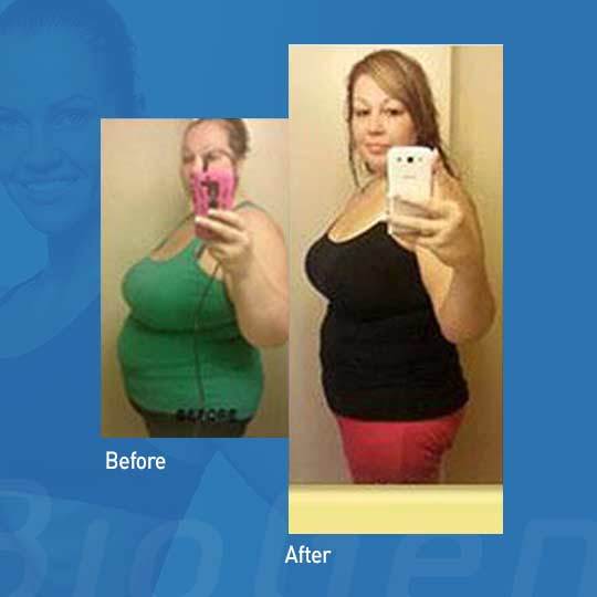 Forskolin Lean & Tone™ Weight Loss Pills